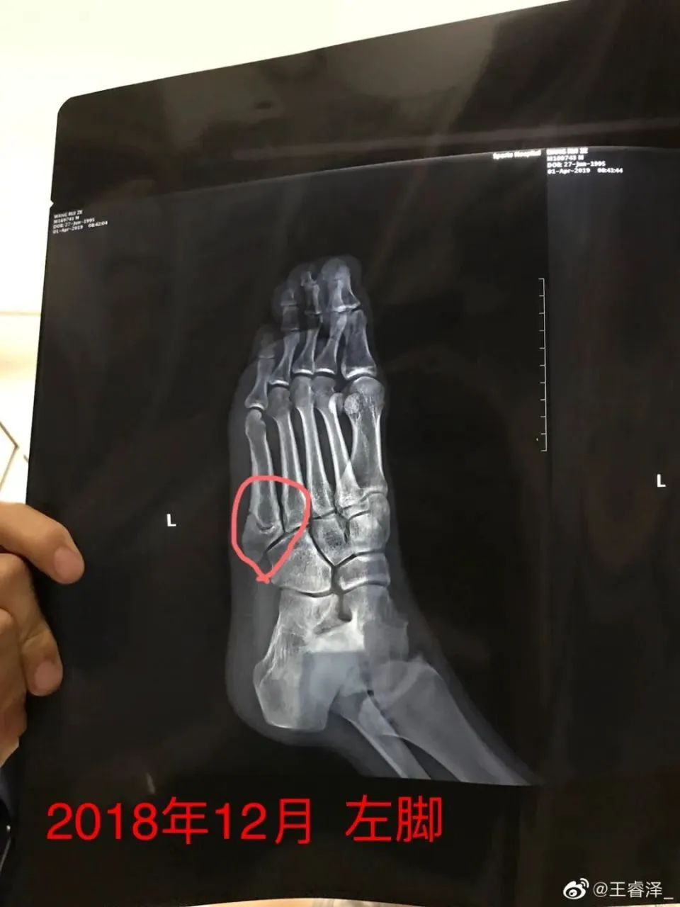 如何通过参加杯赛提升篮球训练效果_1